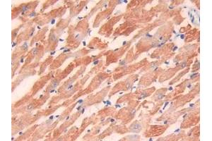 IHC-P analysis of Rat Heart Tissue, with DAB staining. (TNNI3 anticorps  (AA 1-211))