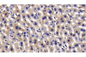 Detection of ATG7 in Mouse Liver Tissue using Polyclonal Antibody to Autophagy Related Protein 7 (ATG7)