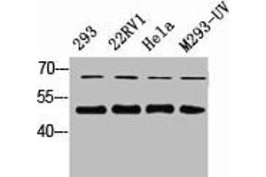 Western Blot analysis of 823 22RV1 HELA 293-UV cells using Smad2/3 Polyclonal Antibody (SMAD2 / SMAD3 anticorps)