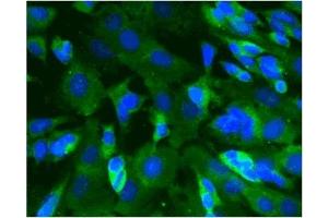 Immunofluorescence (IF) image for anti-Calcium/calmodulin-Dependent Protein Kinase II alpha (CAMK2A) (AA 448-460) antibody (ABIN968458)