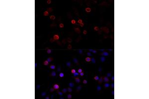 Immunofluorescence analysis of HeLa cells using FLNC antibody (ABIN6127928, ABIN6140681, ABIN6140682 and ABIN6216847) at dilution of 1:100 (40x lens). (FLNC anticorps  (AA 2160-2340))