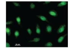 Immunostaining analysis in HeLa cells. (ARNTL2 anticorps)