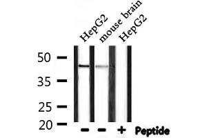 Western blot analysis of extracts from HepG2,mouse brain, using CADM2 Antibody.