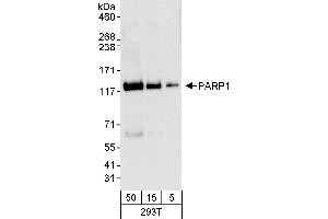 Western Blotting (WB) image for anti-Poly (ADP-Ribose) Polymerase 1 (PARP1) (AA 50-100) antibody (ABIN7455230)