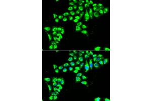 Immunofluorescence analysis of HeLa cells using CLDN2 antibody (ABIN6127703, ABIN6138684, ABIN6138687 and ABIN6222231). (Claudin 2 anticorps  (AA 30-230))