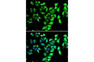 Immunofluorescence analysis of A549 cells using FKBP8 antibody.