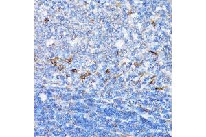 Immunohistochemistry of paraffin-embedded rat spleen using NDE1 antibody.