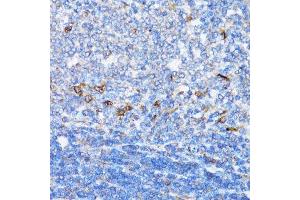 Immunohistochemistry of paraffin-embedded rat spleen using NDE1 antibody. (NDE1 anticorps  (AA 1-110))