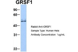 Host:  Rabbit  Target Name:  GRSF1  Sample Type:  Hela  Antibody Dilution:  1. (GRSF1 anticorps  (Middle Region))
