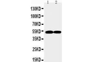 Anti-FLI1 antibody, Western blotting Lane 1: JURKAT Cell Lysate Lane 2: RAJI Cell Lysate (FLI1 anticorps  (N-Term))