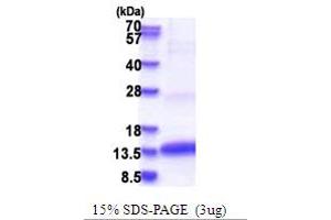 SDS-PAGE (SDS) image for Colipase, Pancreatic (CLPS) (AA 18-112) protein (His tag) (ABIN5853695)