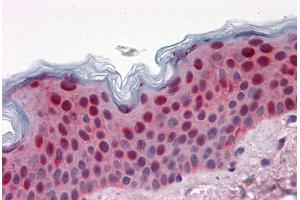 Human Skin: Formalin-Fixed, Paraffin-Embedded (FFPE)