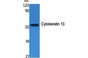 Western Blot (WB) analysis of specific cells using Cytokeratin 13 Polyclonal Antibody. (Cytokeratin 13 anticorps  (Internal Region))