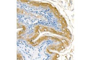 Immunohistochemistry of paraffin embedded rat stomach using CK13 (ABIN7074411) at dilution of 1:1200 (400x lens) (Cytokeratin 13 anticorps  (C-Term))