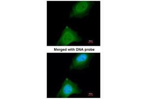 ICC/IF Image Immunofluorescence analysis of paraformaldehyde-fixed HeLa, using ASB9, antibody at 1:200 dilution. (ASB9 anticorps)