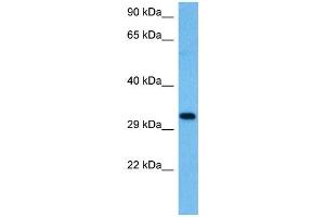 Host:  Rat  Target Name:  KITLG  Sample Tissue:  Rat Skeletal Muscle  Antibody Dilution:  1ug/ml