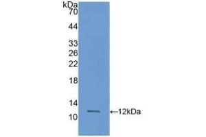 Detection of Recombinant S100A11, Rat using Polyclonal Antibody to S100 Calcium Binding Protein A11 (S100A11) (S100A11 anticorps  (AA 9-98))