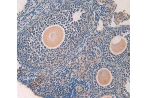 IHC-P analysis of ovary tissue, with DAB staining. (GDF5 anticorps  (AA 358-495))