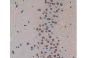 Used in DAB staining on fromalin fixed paraffin- embedded Kidney tissue