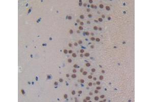 Used in DAB staining on fromalin fixed paraffin- embedded Kidney tissue (FOXP1 anticorps  (AA 122-346))