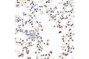 Immunohistochemistry of paraffin-embedded mouse lung using SFPQ antibody.
