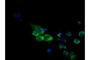Image no. 6 for anti-Cytochrome P450, Family 1, Subfamily A, Polypeptide 2 (CYP1A2) antibody (ABIN1497712)