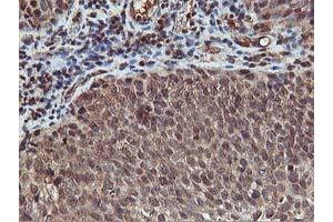 Image no. 9 for anti-V-Akt Murine Thymoma Viral Oncogene Homolog 1 (AKT1) antibody (ABIN1496557) (AKT1 anticorps)