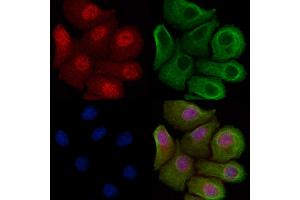 ABIN7094233 and ABIN7098280 staining Hela cells by IF/ICC. (FHL2 anticorps  (Internal Region))