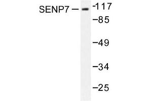 Image no. 1 for anti-SUMO1/sentrin Specific Protease 7 (SENP7) antibody (ABIN271960) (SENP7 anticorps)
