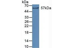 Detection of CYP27B1 in Mouse Kidney Tissue using Polyclonal Antibody to Cytochrome P450 27B1 (CYP27B1) (CYP27B1 anticorps  (AA 256-508))