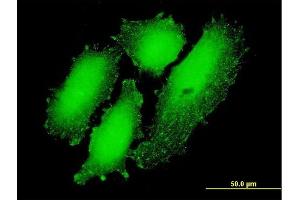 Immunofluorescence of monoclonal antibody to CREB3L4 on HeLa cell.