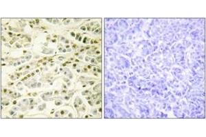 Immunohistochemistry analysis of paraffin-embedded human pancreas tissue, using RAD51L1 Antibody.