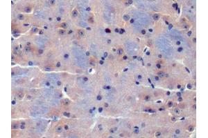 DAB staining on IHC-P; Samples: Mouse Cerebrum Tissue