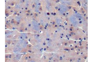 DAB staining on IHC-P; Samples: Mouse Cerebrum Tissue (CDK18 anticorps  (AA 121-402))