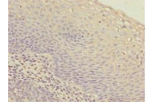 Immunohistochemistry of paraffin-embedded human tonsil tissue using ABIN7156265 at dilution of 1:100 (IKbIP anticorps  (AA 121-350))