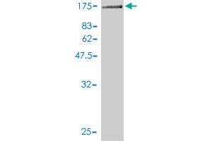 Western Blot detection against Immunogen (125.