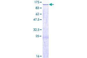Image no. 1 for SATB Homeobox 2 (SATB2) protein (GST tag) (ABIN1319179)