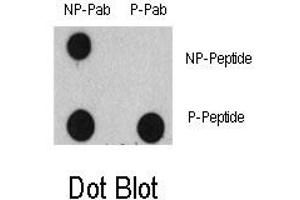 Image no. 1 for anti-Epidermal Growth Factor Receptor (EGFR) (pTyr1125) antibody (ABIN358328) (EGFR anticorps  (pTyr1125))