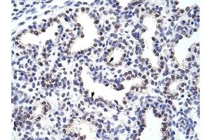 WNT2B antibody was used for immunohistochemistry at a concentration of 4-8 ug/ml to stain Alveolar cells (arrows) in Human Lung. (WNT2B anticorps  (Middle Region))