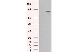 Western Blotting (WB) image for anti-Betaine--Homocysteine S-Methyltransferase (BHMT) antibody (ABIN1496916)
