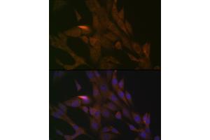 Immunofluorescence analysis of NIH-3T3 cells using PER3 Rabbit mAb (ABIN7269225) at dilution of 1:100 (40x lens).
