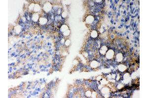 Anti- HLA-A Picoband antibody,IHC(P) IHC(P): Rat Intestine Tissue (HLA-A anticorps  (N-Term))