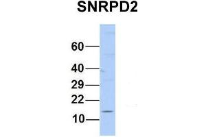 Host:  Rabbit  Target Name:  SNRPD2  Sample Type:  Human MCF7  Antibody Dilution:  1. (SNRPD2 anticorps  (N-Term))