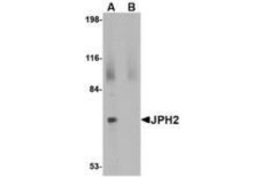 Image no. 1 for anti-Junctophilin 2 (JPH2) (C-Term) antibody (ABIN341698) (Junctophilin 2 anticorps  (C-Term))