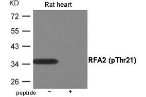 Western blot analysis of extracts from Rat heart using RFA2 (Phospho-Thr21) Antibody. (RPA2 anticorps  (pThr21))