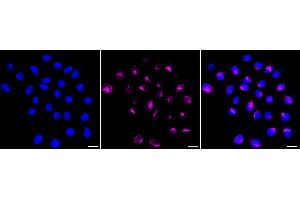 Immunocytochemical staining of HepG2 cells with NDC80 antibody (ABIN7799564), 1:1,000).