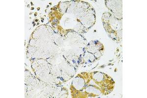 Immunohistochemistry of paraffin-embedded human esophagus using PPP1CA antibody.