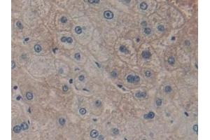 Detection of GSTt2 in Human Liver Tissue using Polyclonal Antibody to Glutathione S Transferase Theta 2 (GSTt2)