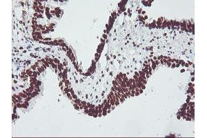 Image no. 7 for anti-Fragile X Mental Retardation 1 (FMR1) (AA 36-279) antibody (ABIN1491454)