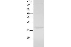 Western Blotting (WB) image for Ras-Related C3 Botulinum Toxin Substrate 3 (Rho Family, Small GTP Binding Protein Rac3) (RAC3) (AA 1-189) protein (His tag) (ABIN7124791)